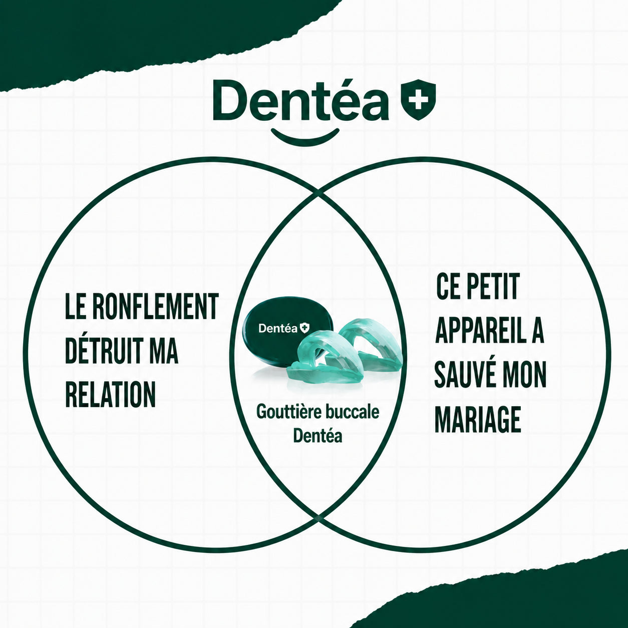L'Embout Buccal Anti-Ronflement SilentFit (Taille Universelle)