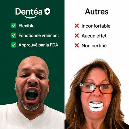 L'Embout Buccal Anti-Ronflement SilentFit (Taille Universelle)