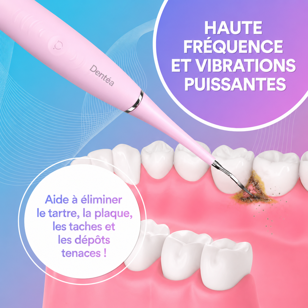 Nettoyeur Dentaire Ultrasonique